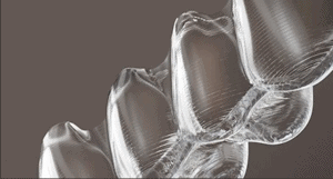 Ortodoncia Invisalign Leon